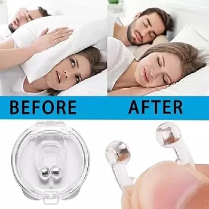 Anti Nose